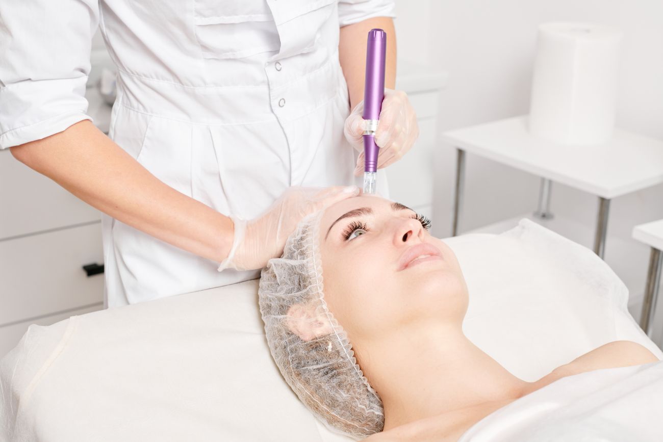 Mezoterapia iglowa – naturalne rozwiazanie problemow skornych